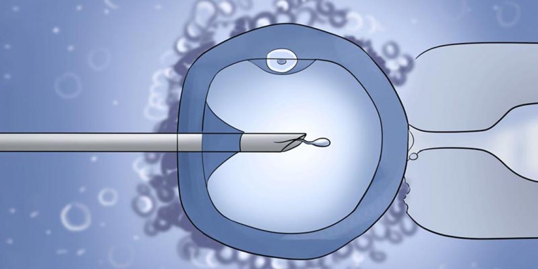 Tüp Bebek Tedavisi  (IVF, In Vitro Fertilization) Nedir ?